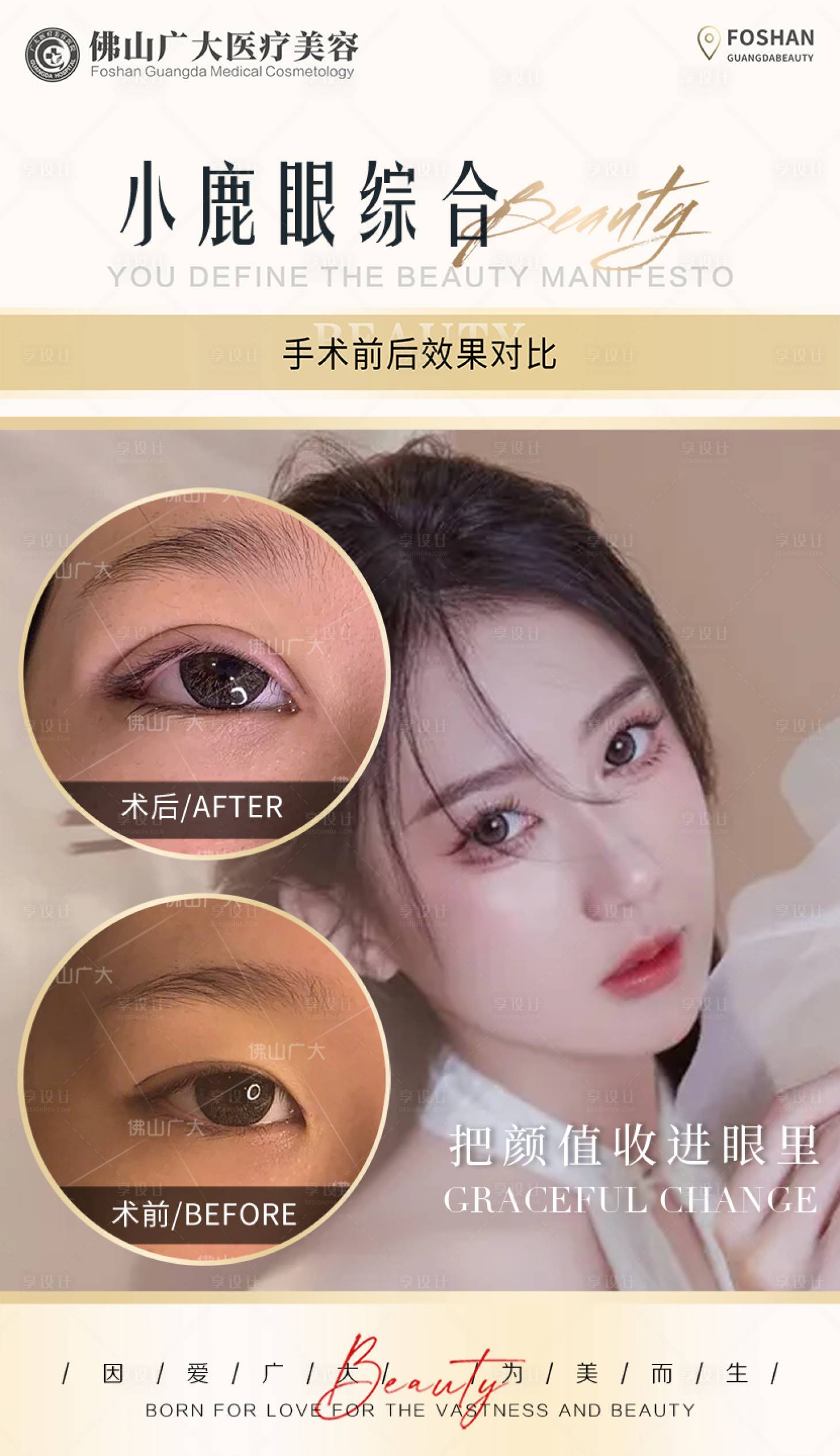 源文件下載【享設計】搜索編號：42870008991953773【醫美眼綜合案例對比海報】