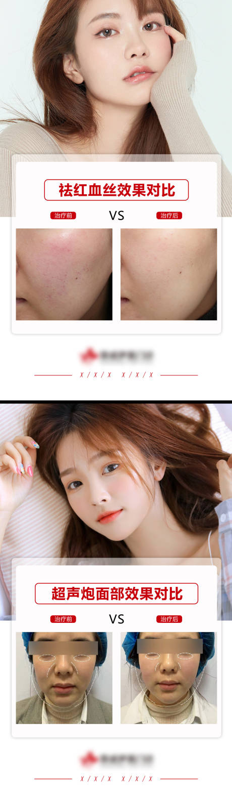 源文件下載【醫(yī)美案例模板】編號：36120009633215190