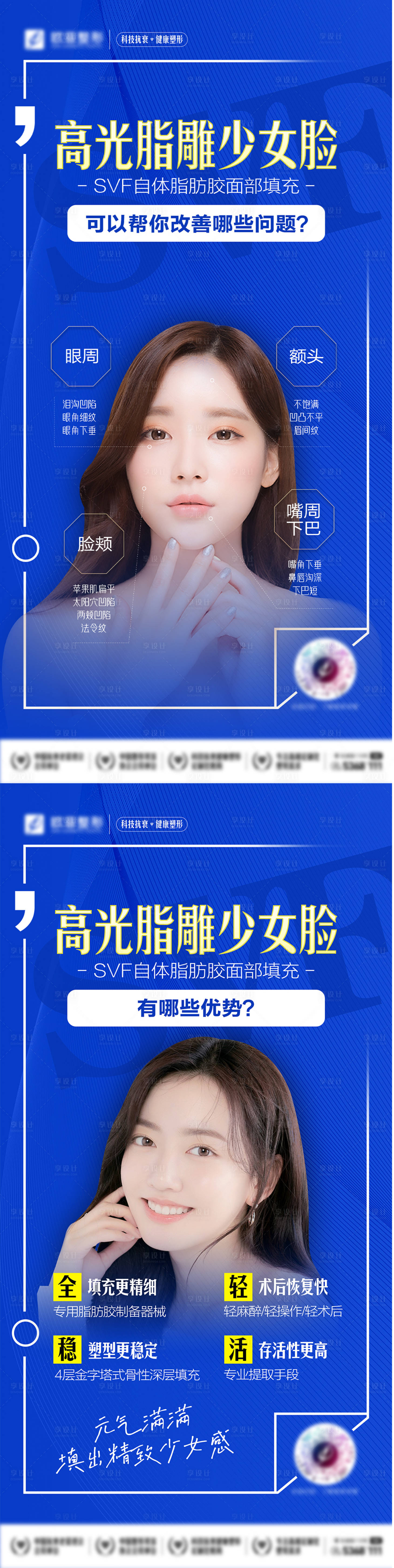 源文件下载【SVF自体脂肪面部填充】编号：42000009515129702