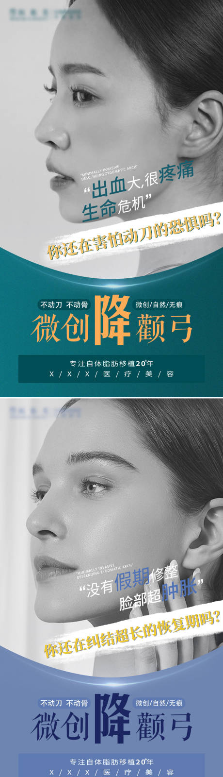 源文件下载【医美降颧骨海报】编号：64180009289593852