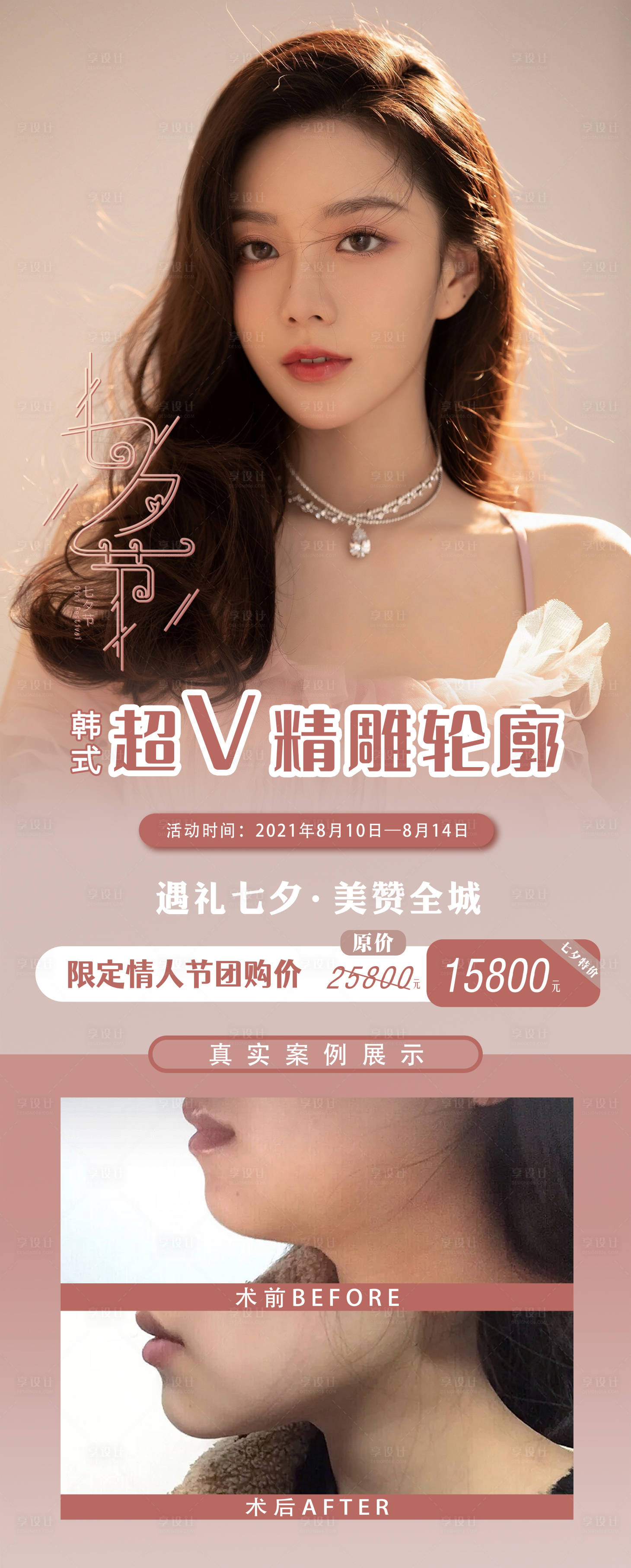 源文件下載【享設計】搜索編號：14740009519346488【醫美七夕輪廓活動海報】