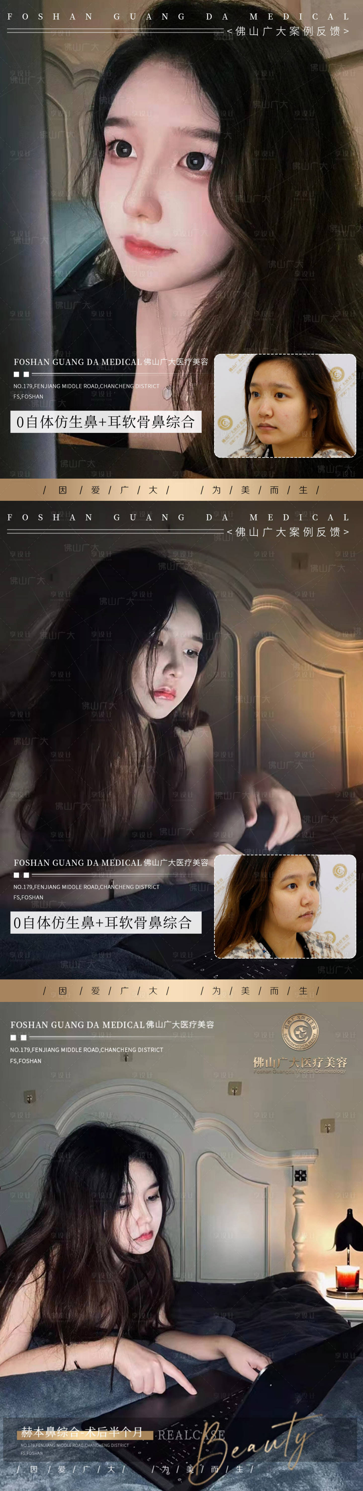 源文件下載【享設計】搜索編號：64310009617697940【醫美整形真人案例分享海報】