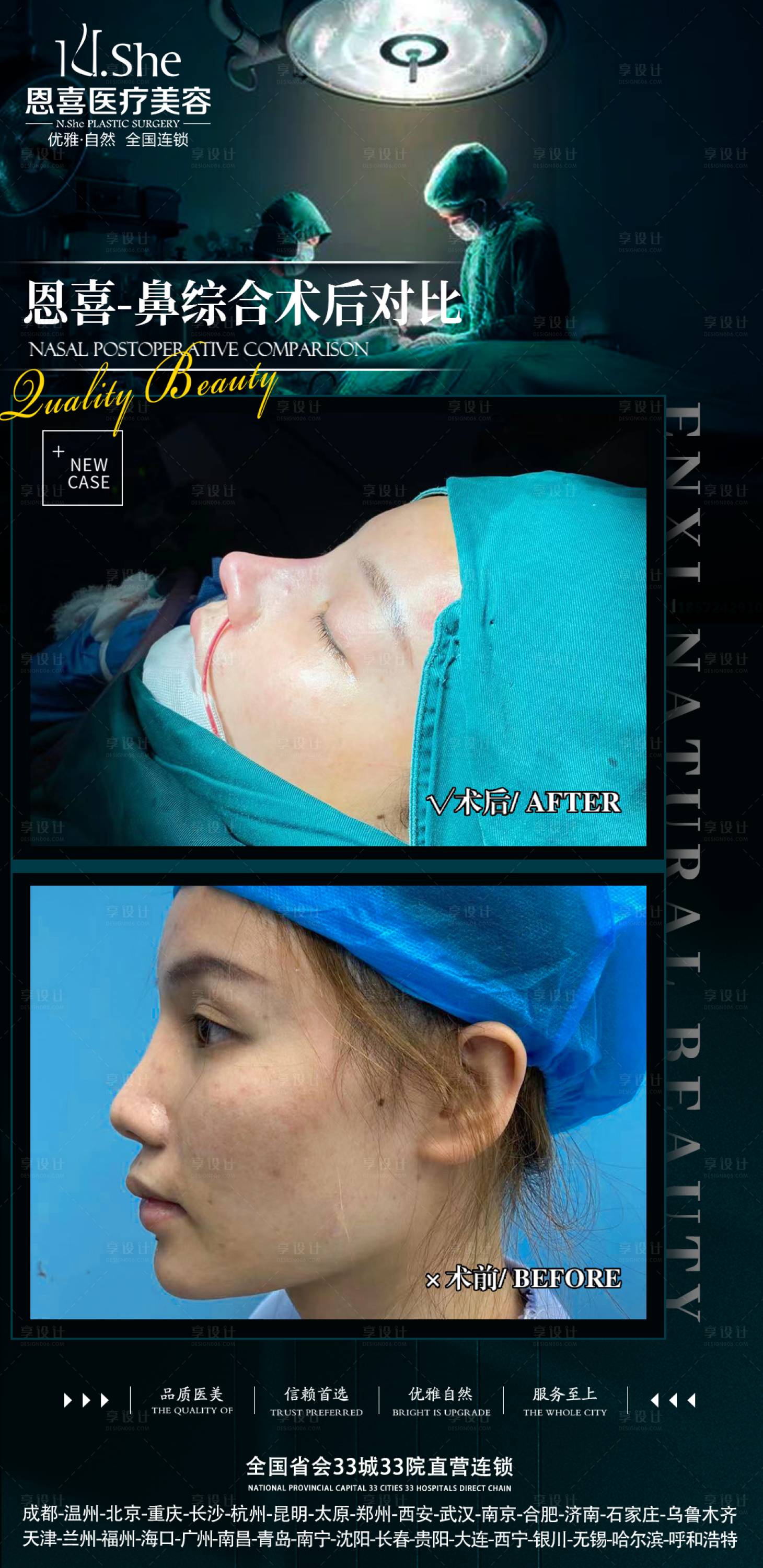 源文件下载【享设计】搜索编号：87560009278049903【医美案例对比海报】