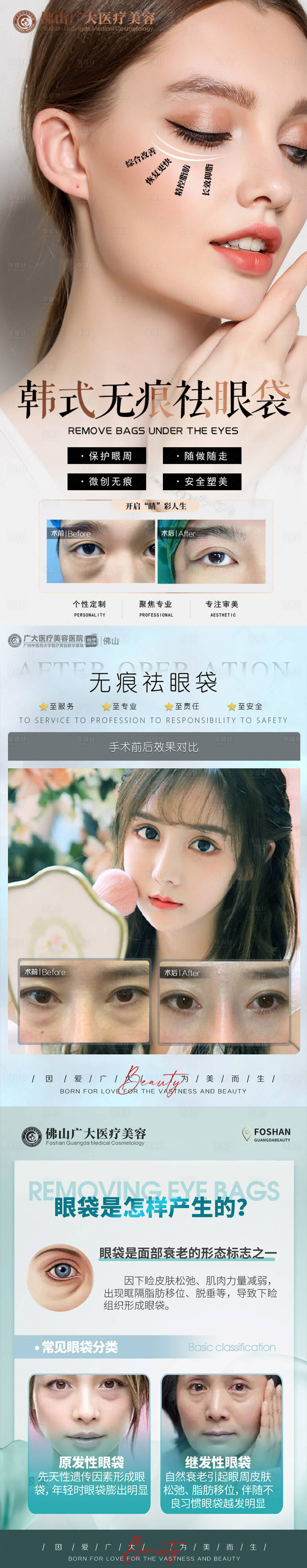 源文件下載【享設(shè)計】搜索編號：45480009640674148【醫(yī)美祛眼袋案例科普海報】