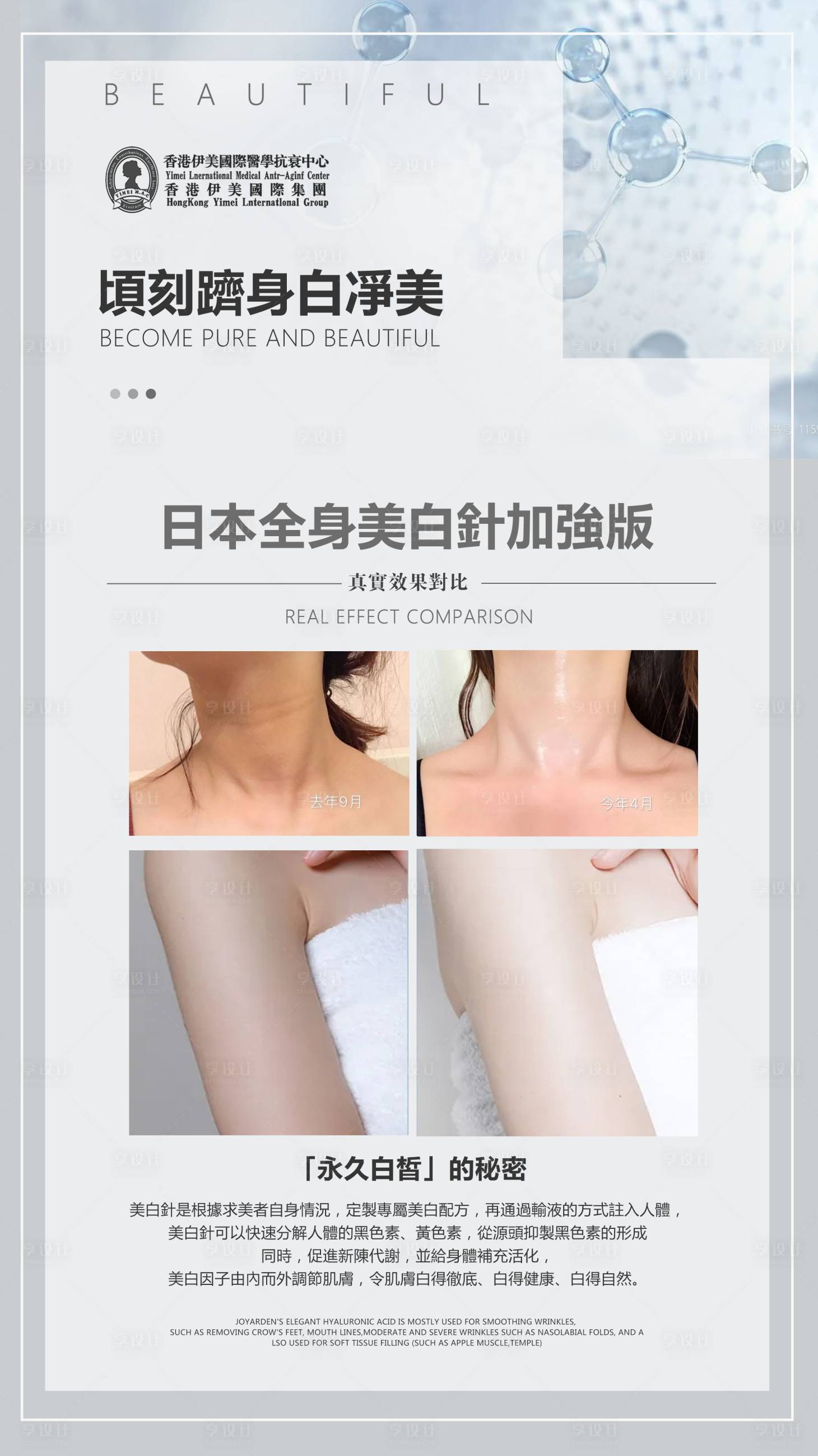 源文件下载【效果对比图展架】编号：56240009453644775