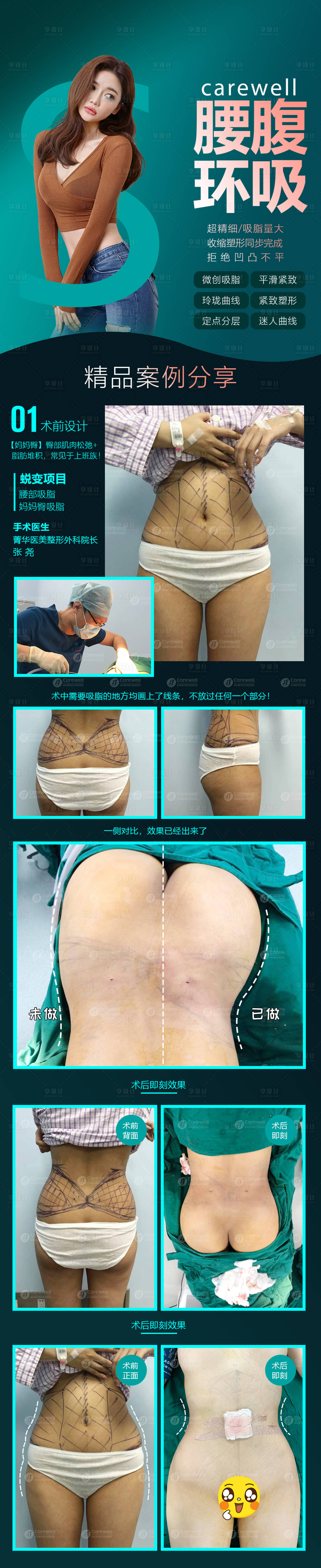 源文件下載【享設(shè)計】搜索編號：98340009256634497【腰腹環(huán)吸電商詳情頁】