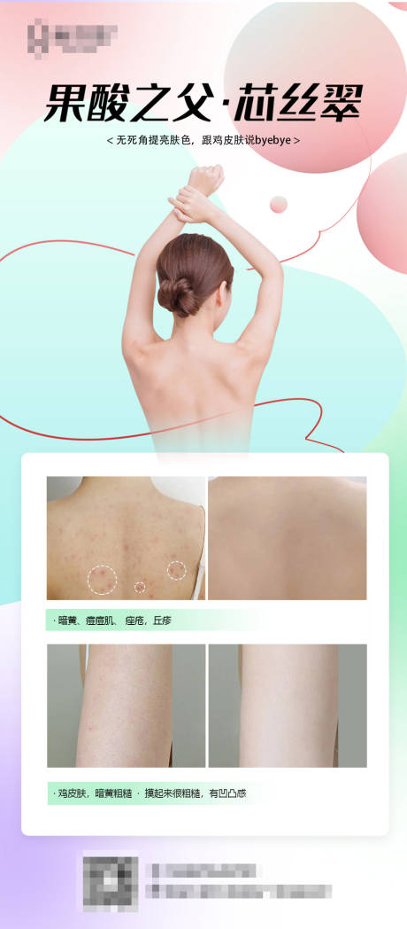 源文件下載【輕醫(yī)美果酸煥膚 】編號：76210009269804224