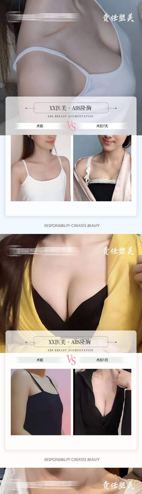 源文件下載【享設計】搜索編號：84330009661017599【醫美豐胸案例對比】