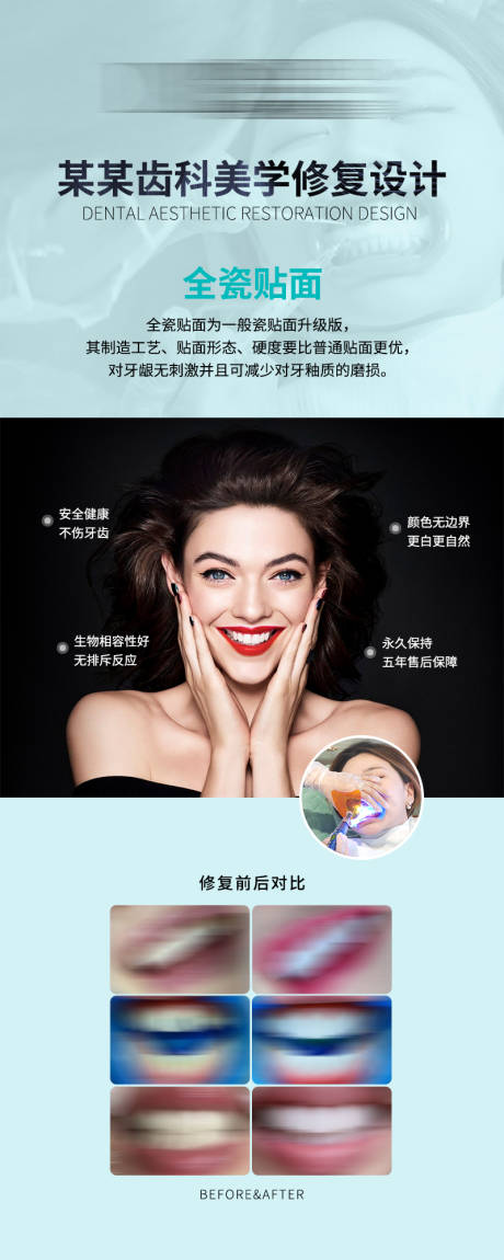 源文件下載【牙齒美容瓷貼面海報】編號：98030009512303699
