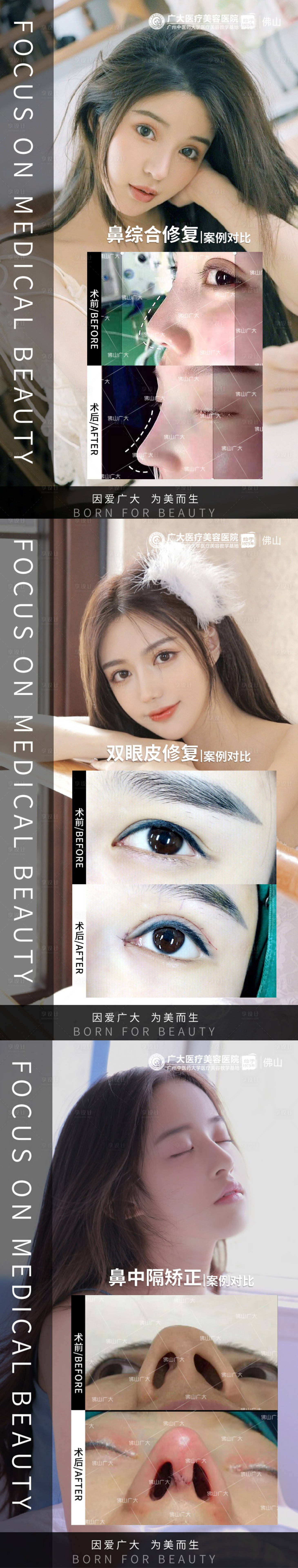 源文件下载【整形修复真人案例分享集】编号：68700009283814881