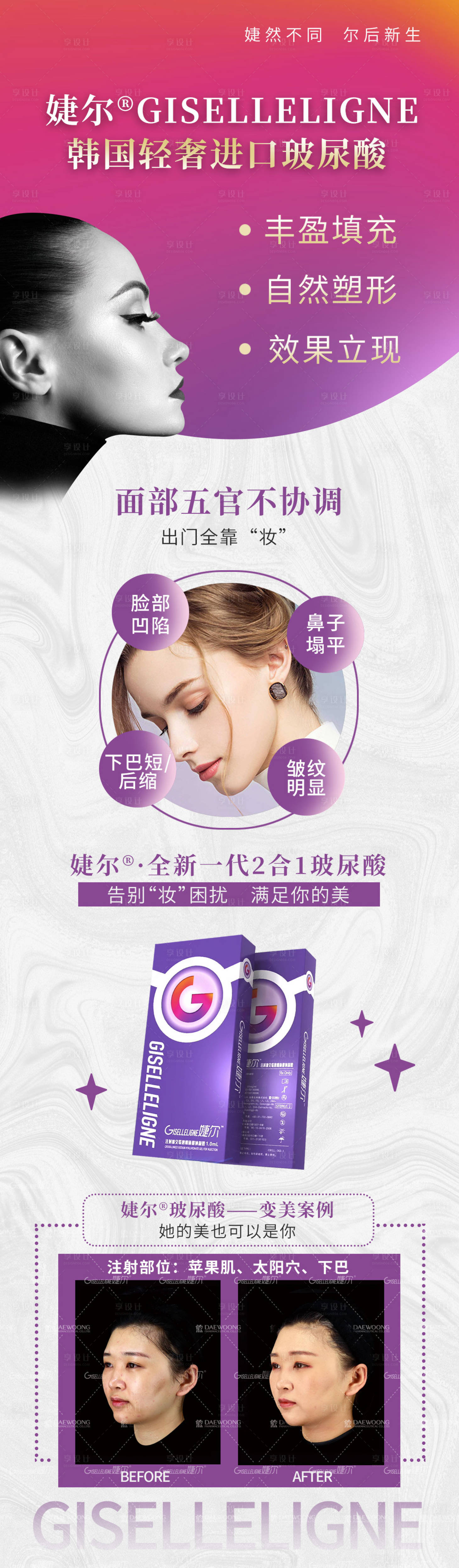 源文件下載【享設計】搜索編號：69650009496487514【婕爾玻尿酸長圖】