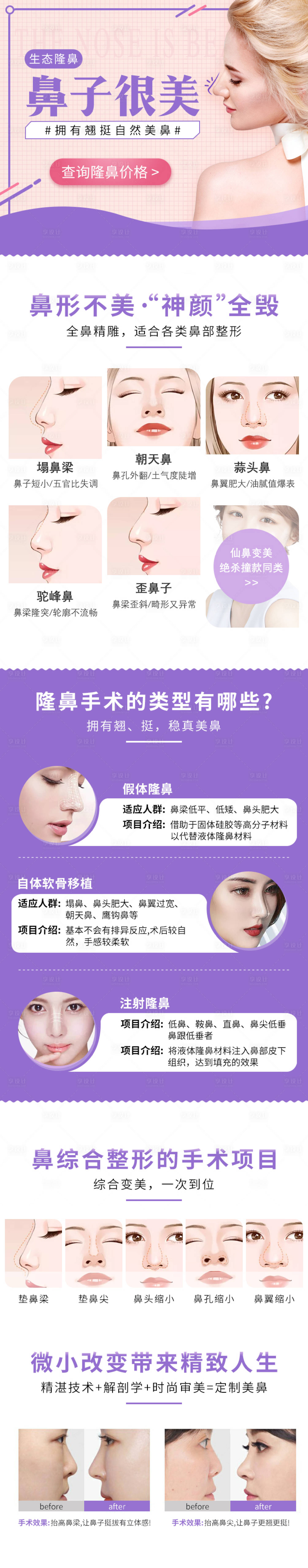 源文件下载【医美隆鼻整形专题页】编号：22730009679747945