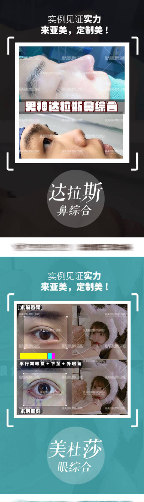 源文件下载【医美整形案例对比】编号：61280009606915261