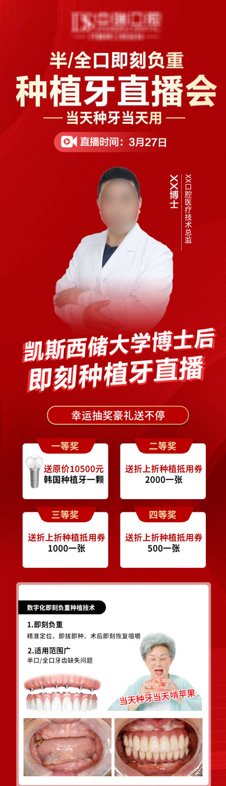 源文件下載【種植牙活動長圖】編號：13720009430185630