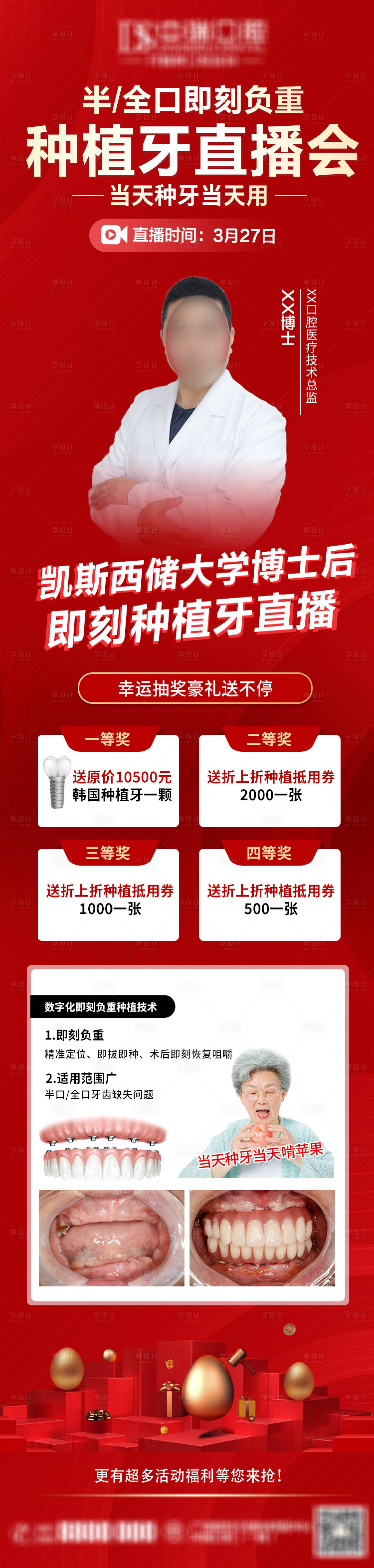 源文件下載【享設計】搜索編號：13720009430185630【種植牙活動長圖】