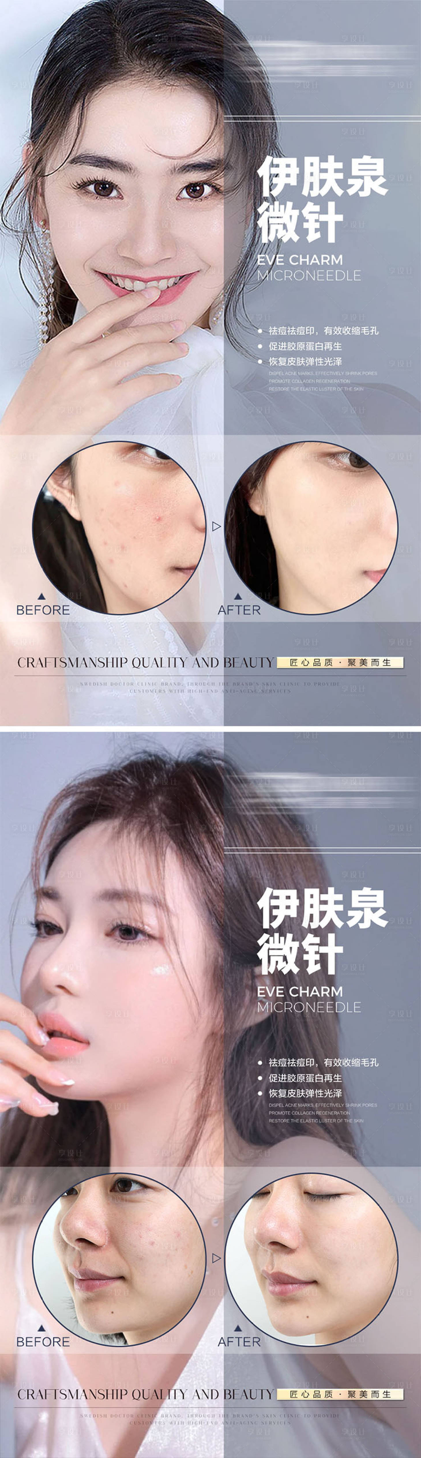 源文件下載【享設計】搜索編號：20890009358454227【醫美整形抗衰案例對比系列海報】