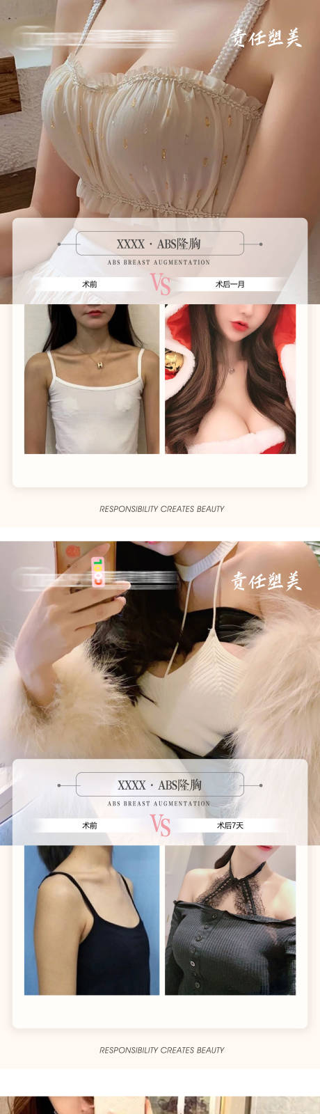 源文件下载【医美隆胸案例对比系列海报】编号：62230009588406272