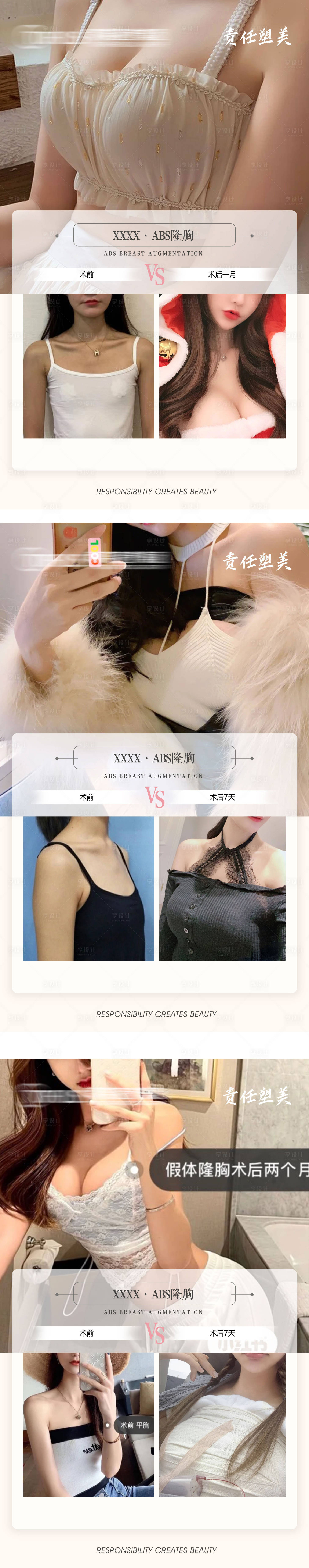 源文件下载【医美隆胸案例对比系列海报】编号：62230009588406272