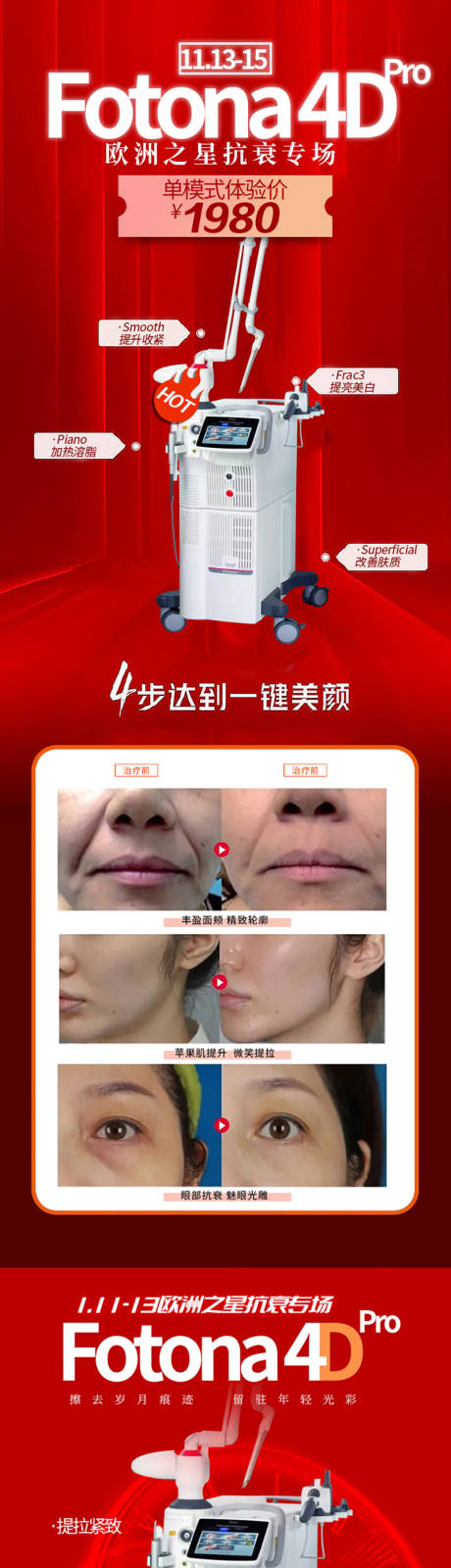 源文件下載【FOTONA歐洲之星抗衰提升】編號：28060009730298386