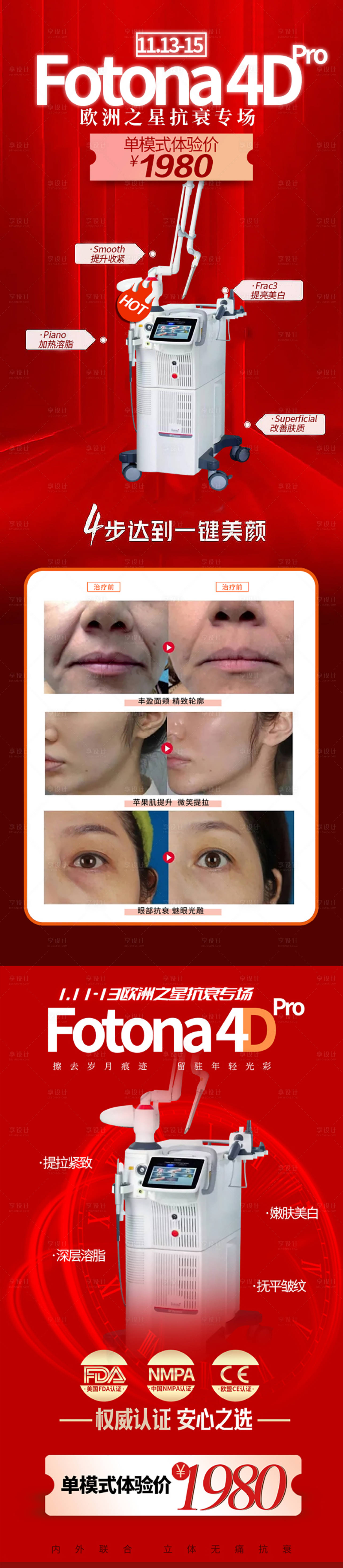 源文件下載【FOTONA歐洲之星抗衰提升】編號：28060009730298386