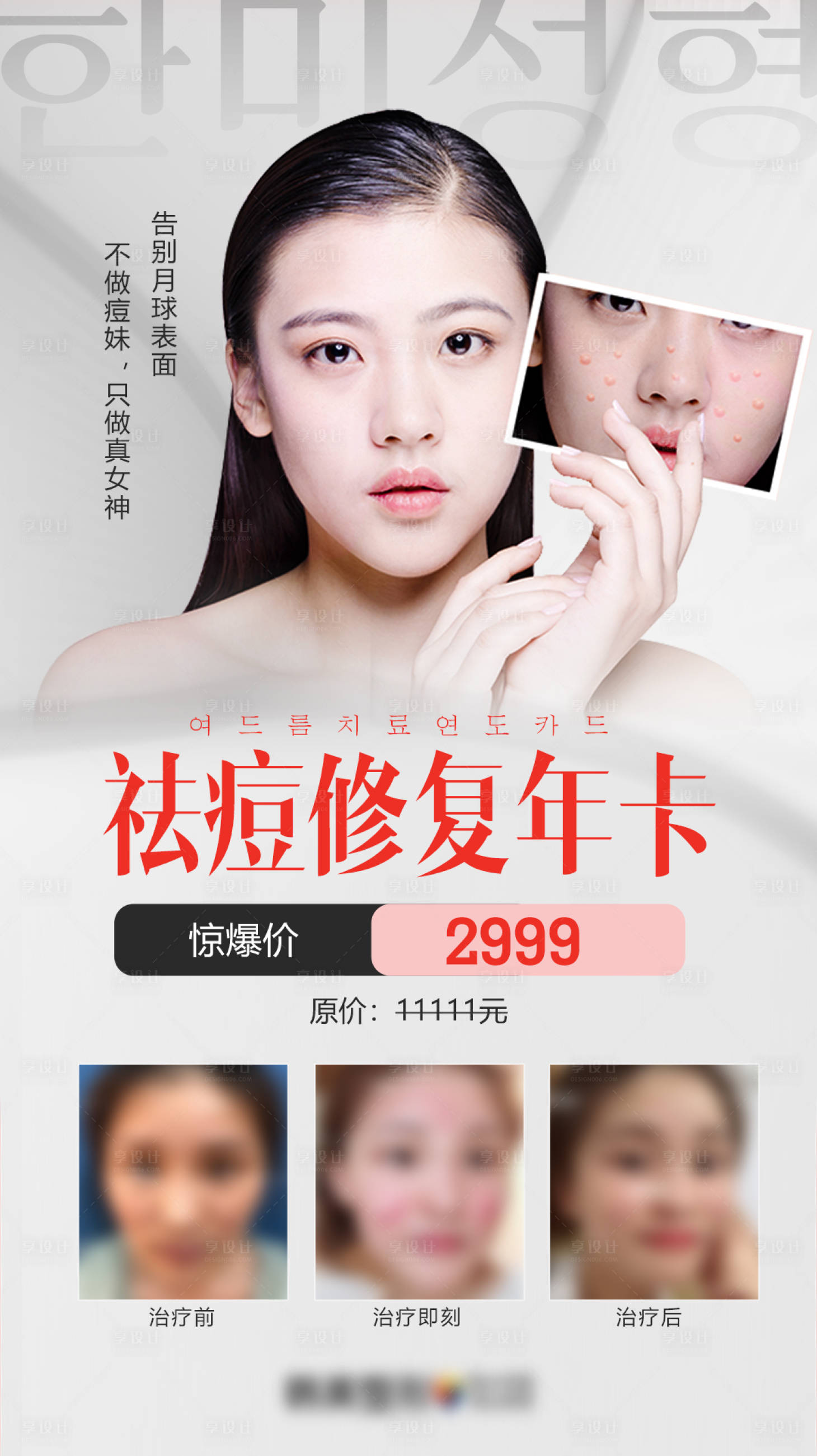 源文件下载【医学美容皮肤科祛痘修复年卡促销海报】编号：60450009504502091