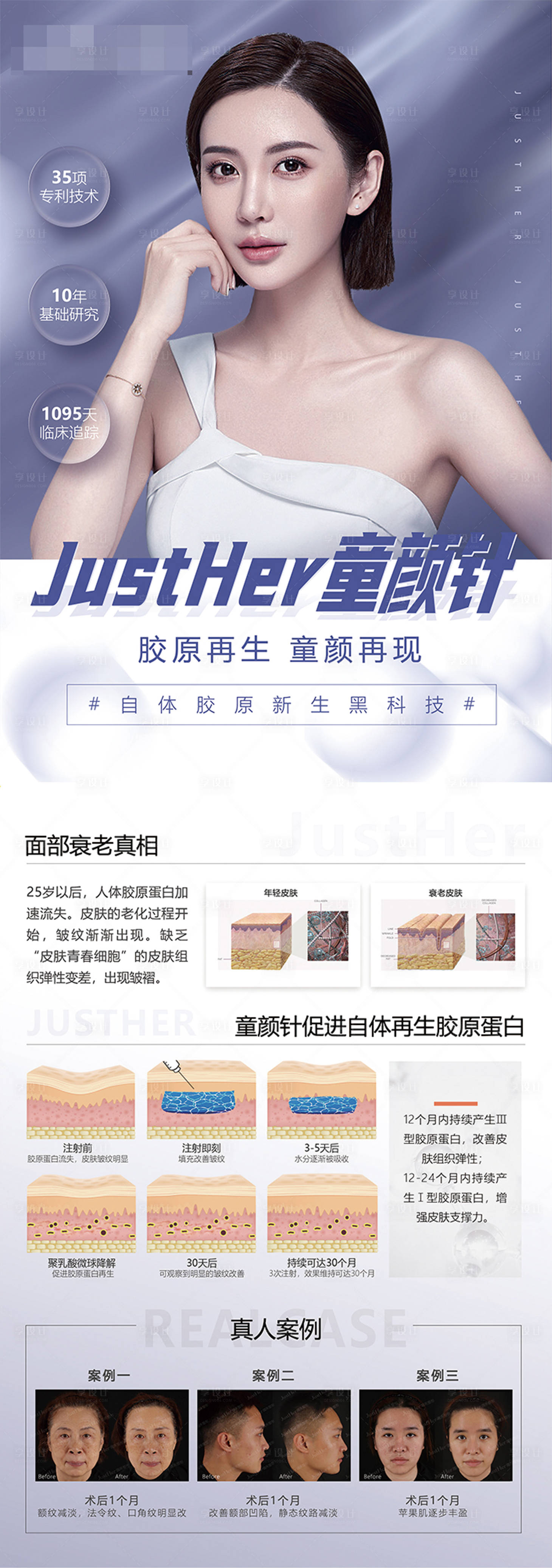 源文件下載【童顏針】編號：17790009719211702