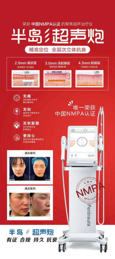 源文件下載【享設(shè)計(jì)】搜索編號(hào)：57500009156724387【醫(yī)美超聲炮展架】