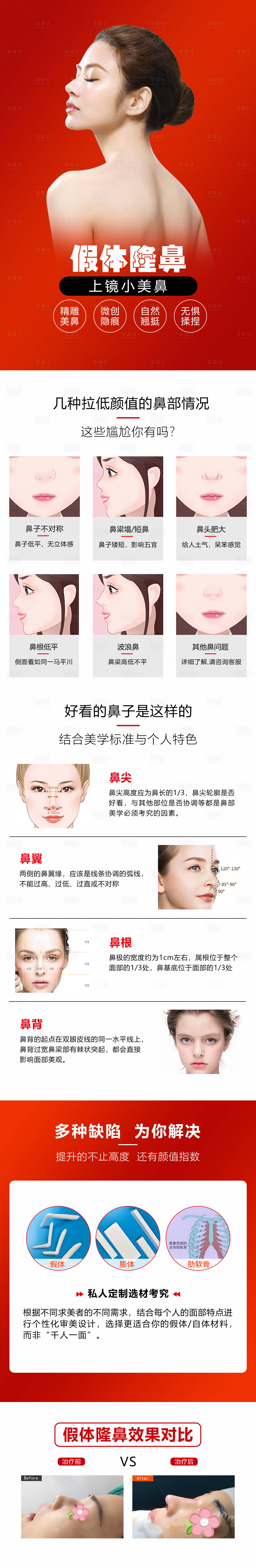 源文件下載【享設計】搜索編號：57490009646114363【醫美隆鼻案例長圖】