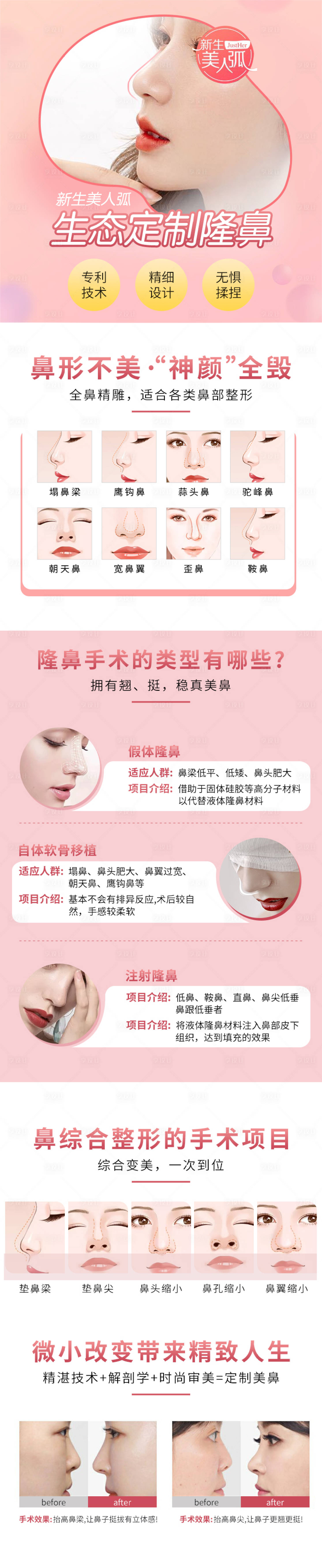 源文件下载【享设计】搜索编号：49000009679966490【医美隆鼻整形专题页竞价页】