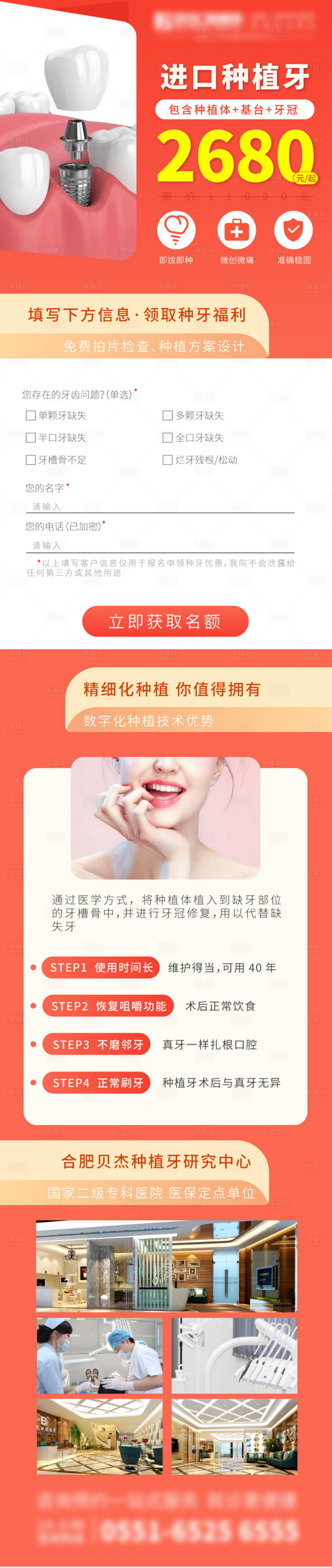 源文件下載【享設計】搜索編號：37410009293613281【進口種植牙海報】