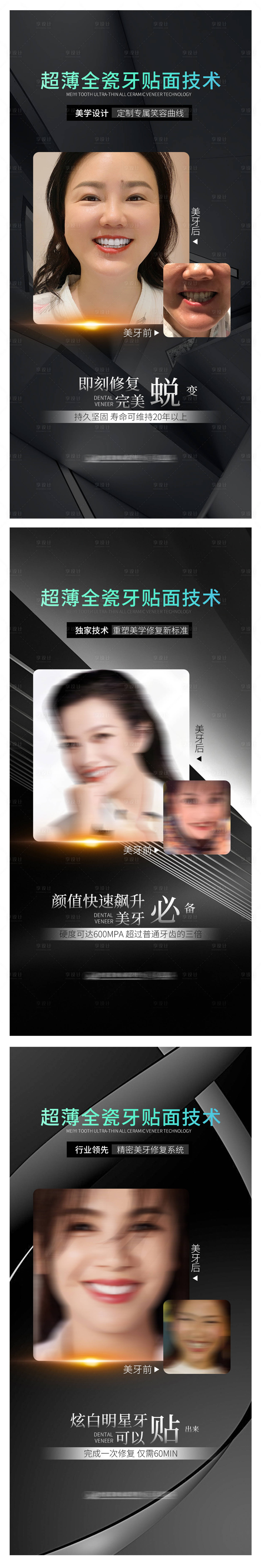 源文件下載【牙齒美容醫美海報】編號：85800009761153982