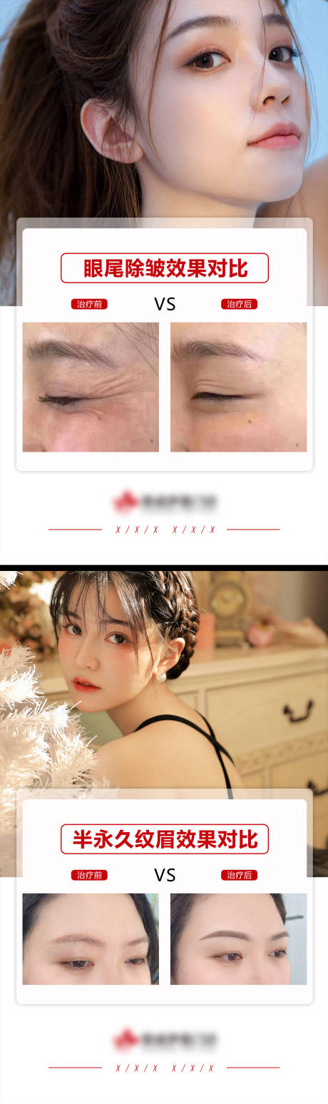 源文件下载【医美案例模板】编号：87190009629481004