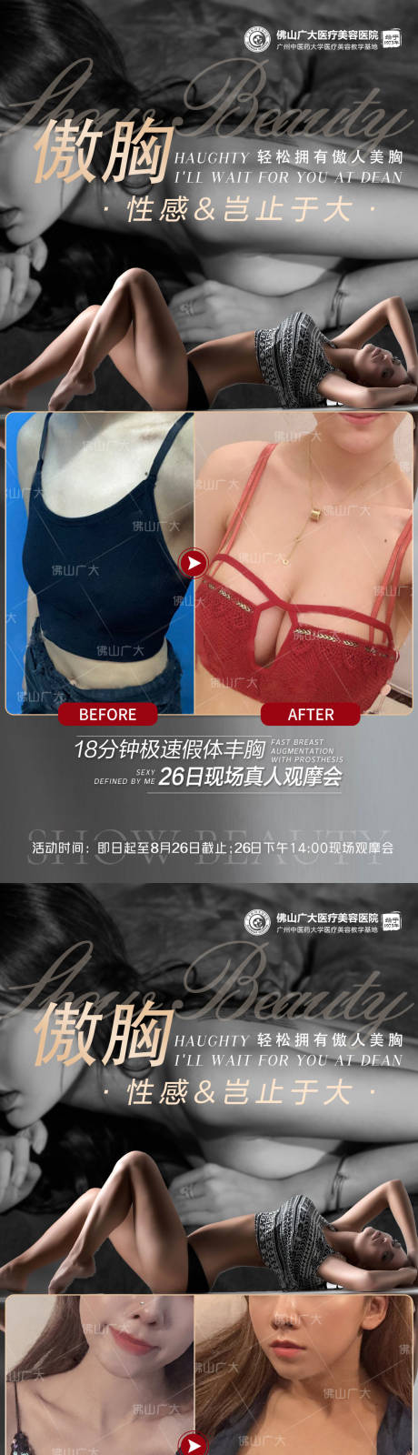 源文件下载【医美隆胸案例活动系列海报】编号：71030009677886202