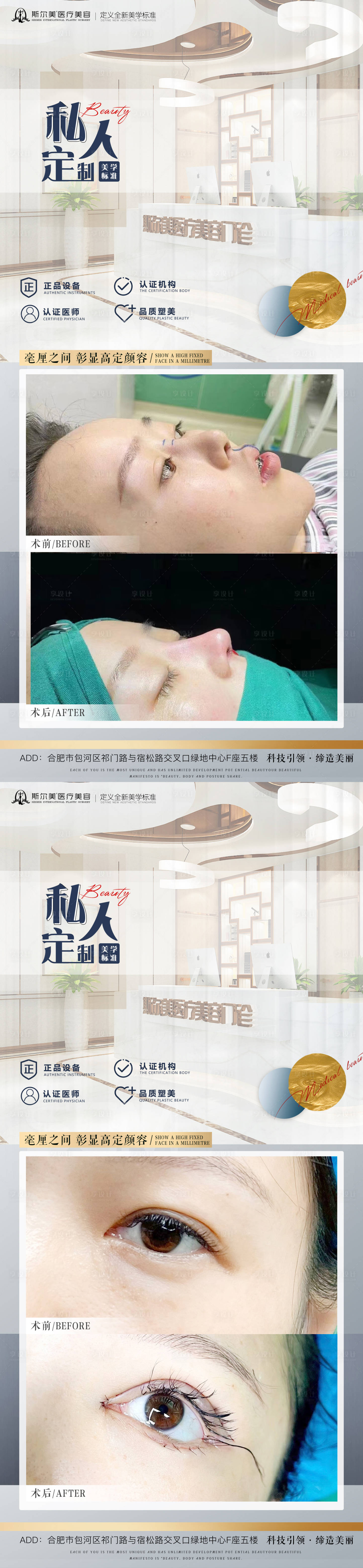 源文件下载【享设计】搜索编号：33940009556564397【医美案例对比】