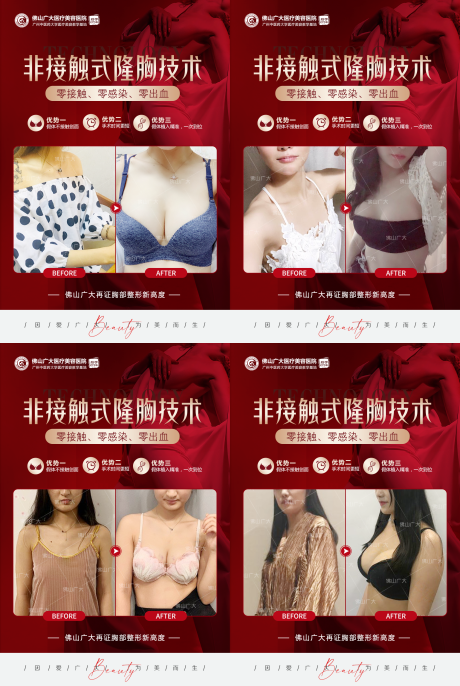源文件下载【医美隆胸案例活动】编号：42720009637329710