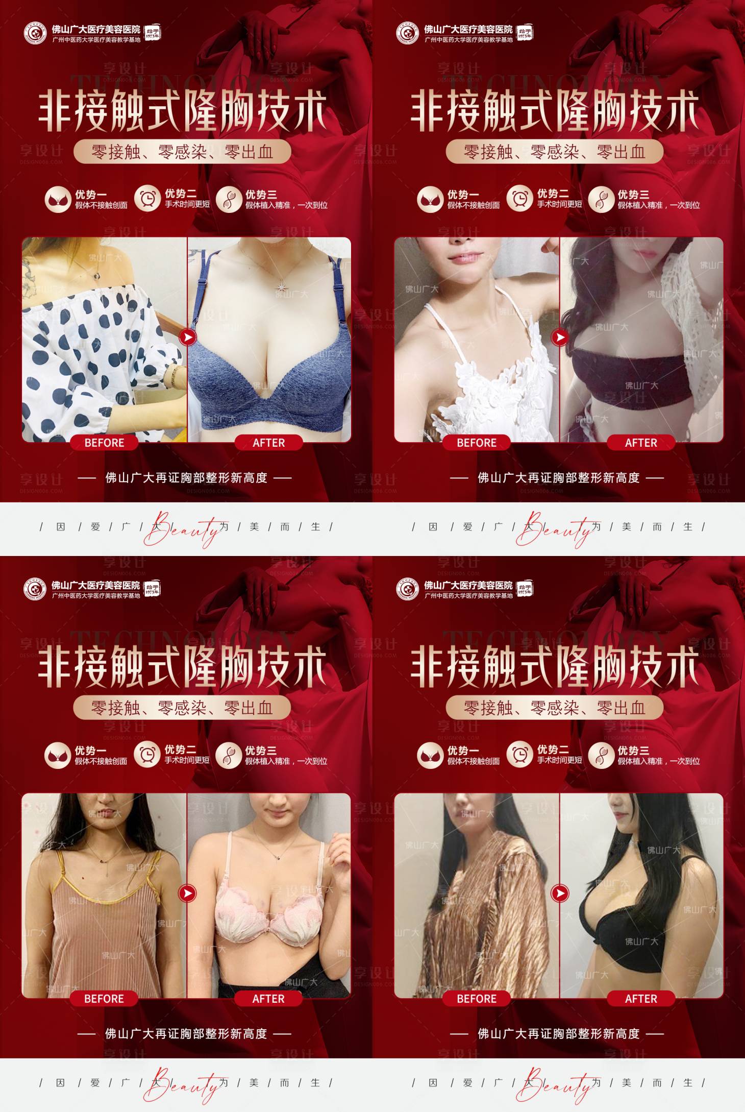 源文件下載【享設計】搜索編號：42720009637329710【醫美隆胸案例活動】