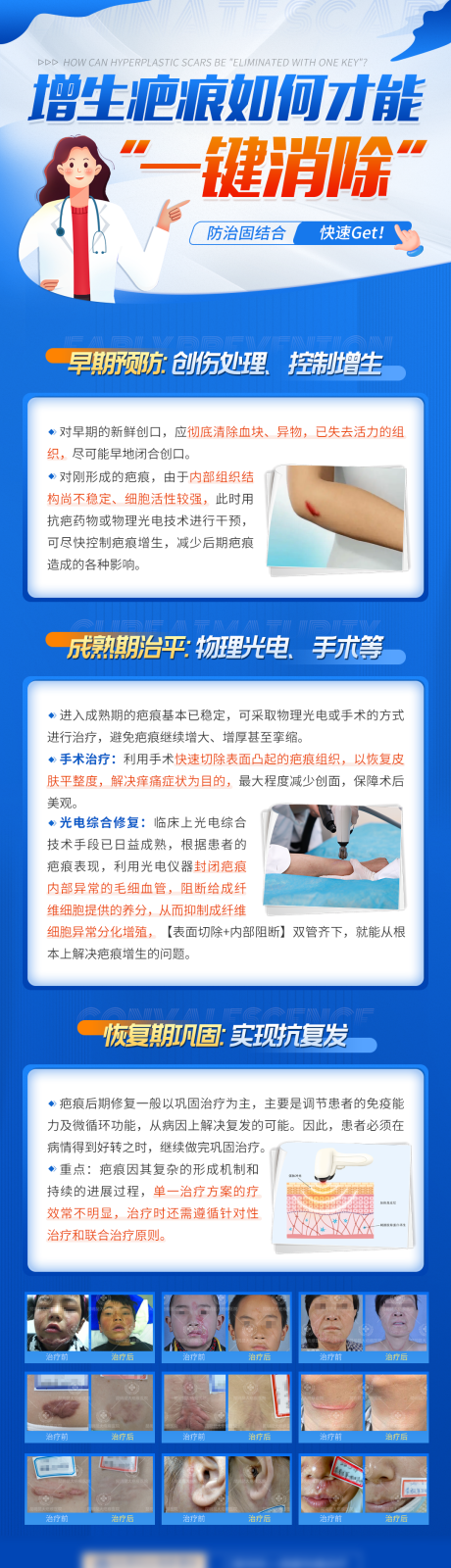 源文件下载【医疗增生疤痕如何才能一键消除科普海报】编号：95510009284927798