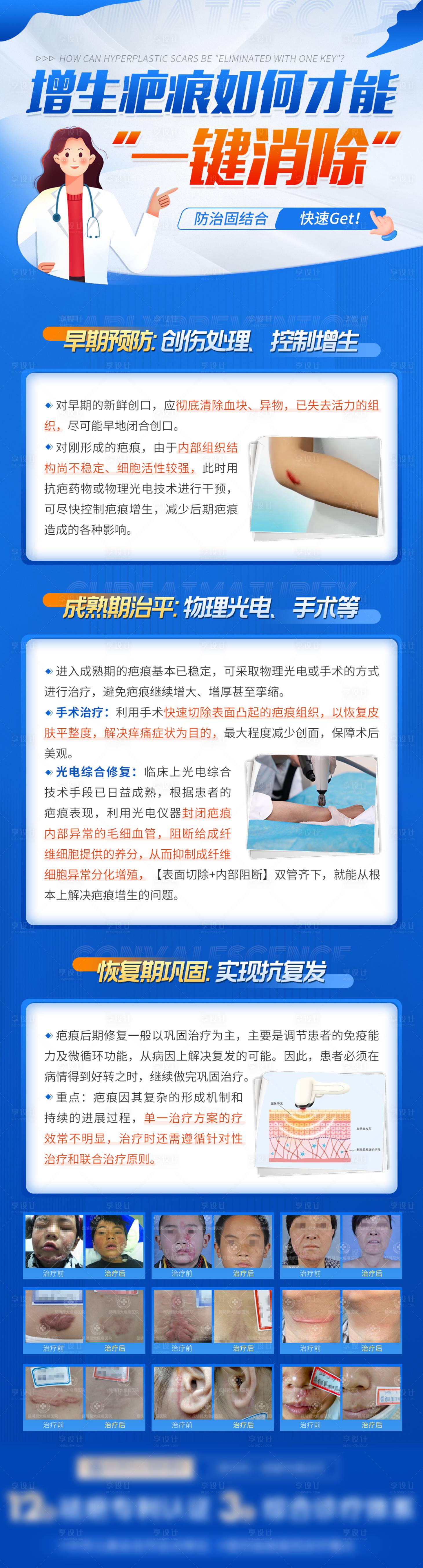 源文件下載【享設計】搜索編號：95510009284927798【醫療增生疤痕如何才能一鍵消除科普海報】