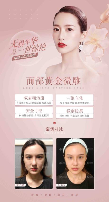 源文件下载【医美黄金微雕海报】编号：15200009256671913