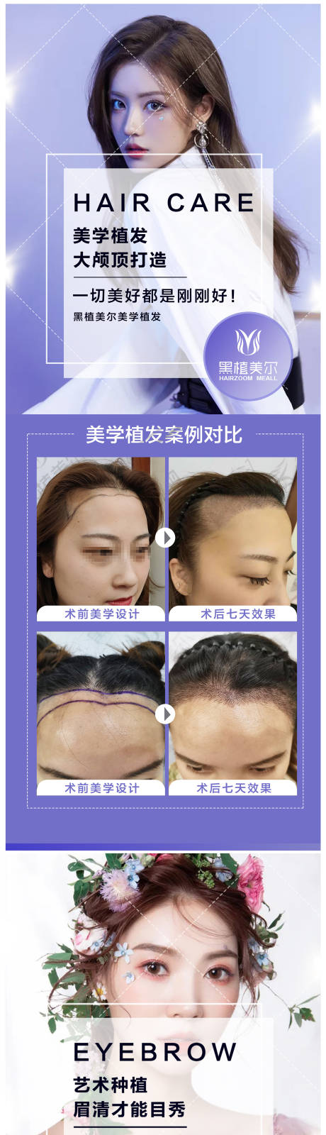 源文件下载【医美植发植眉海报】编号：14860009478374671