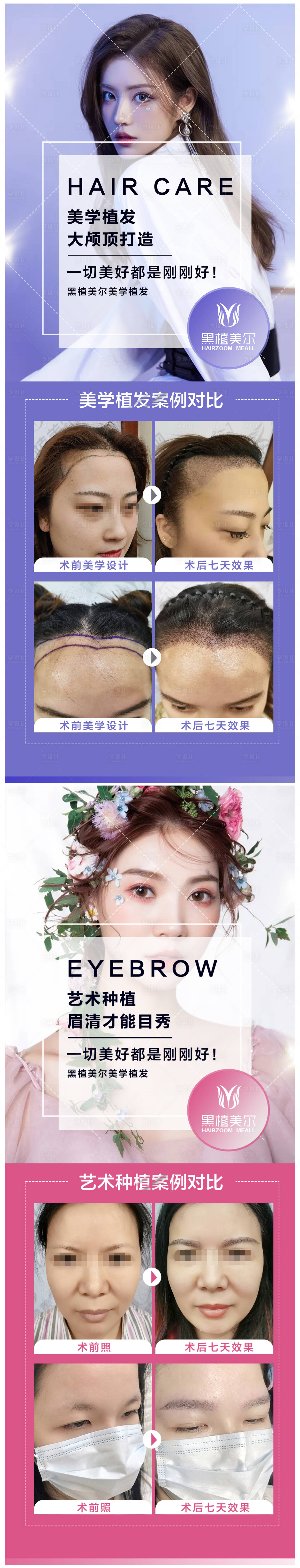源文件下载【享设计】搜索编号：14860009478374671【医美植发植眉海报】