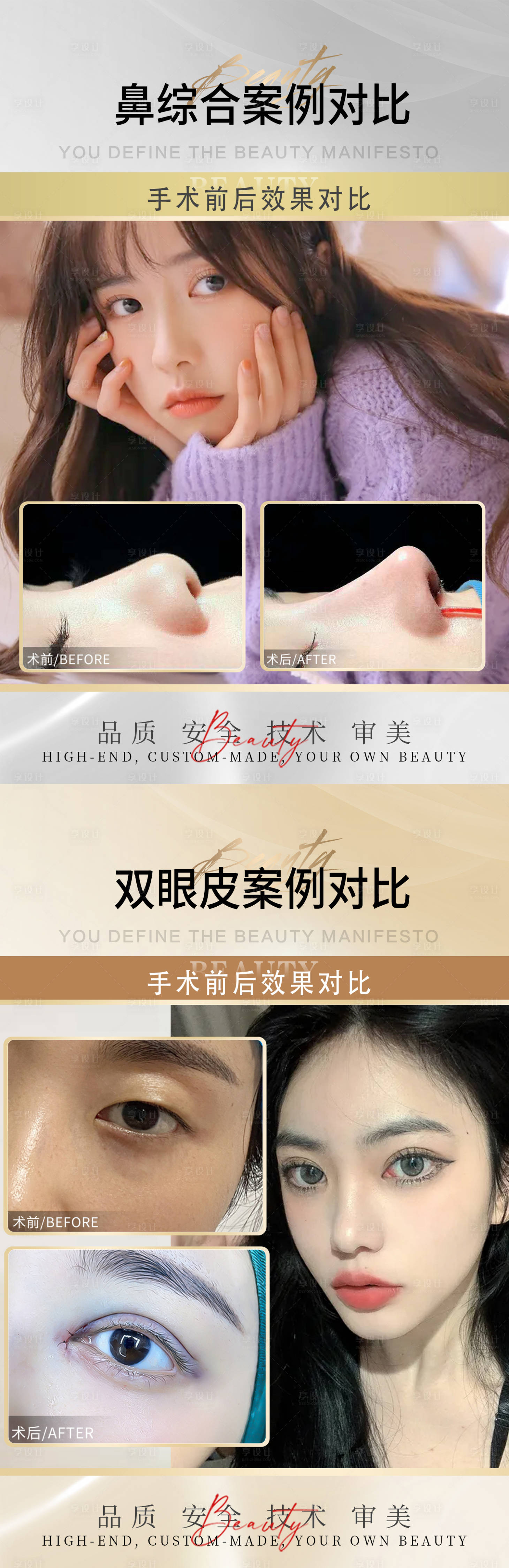 源文件下载【享设计】搜索编号：67200009739104314【医美案例海报】