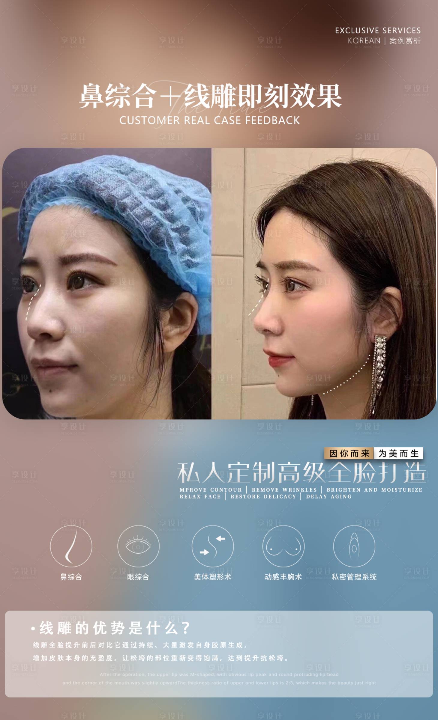 源文件下载【享设计】搜索编号：67200009451442302【医美整形鼻综合线雕案例】