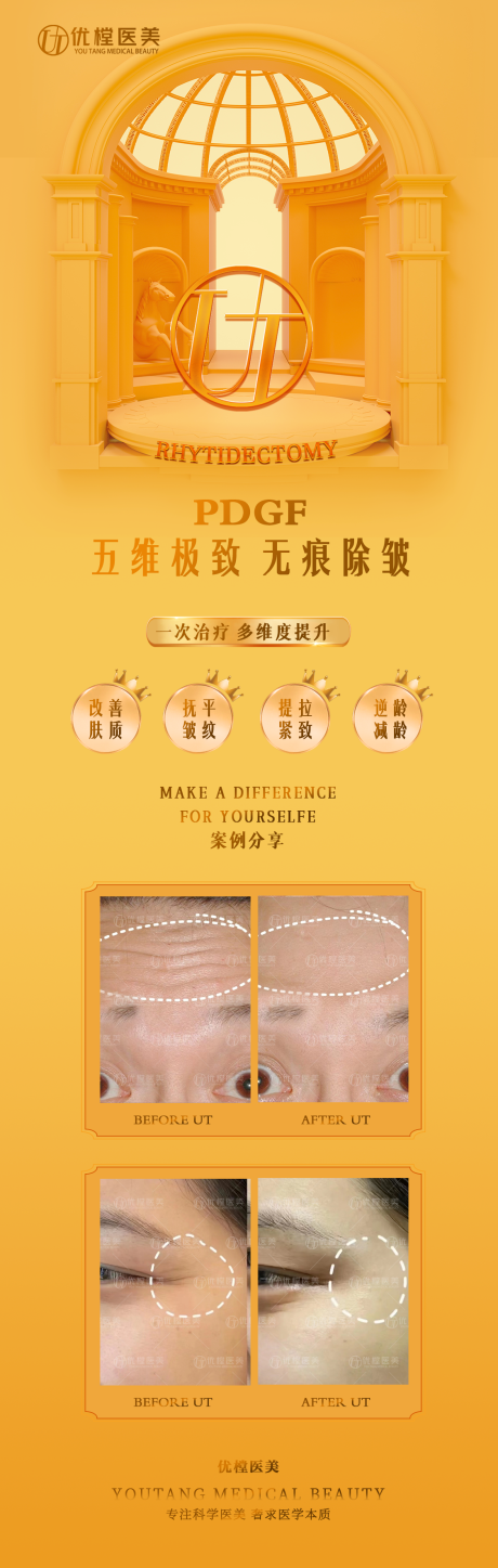 源文件下載【享設計】搜索編號：62760009619149685【醫美除皺促銷海報】