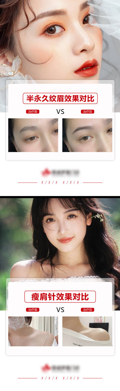 源文件下载【医美案例模板】编号：45700009646821599