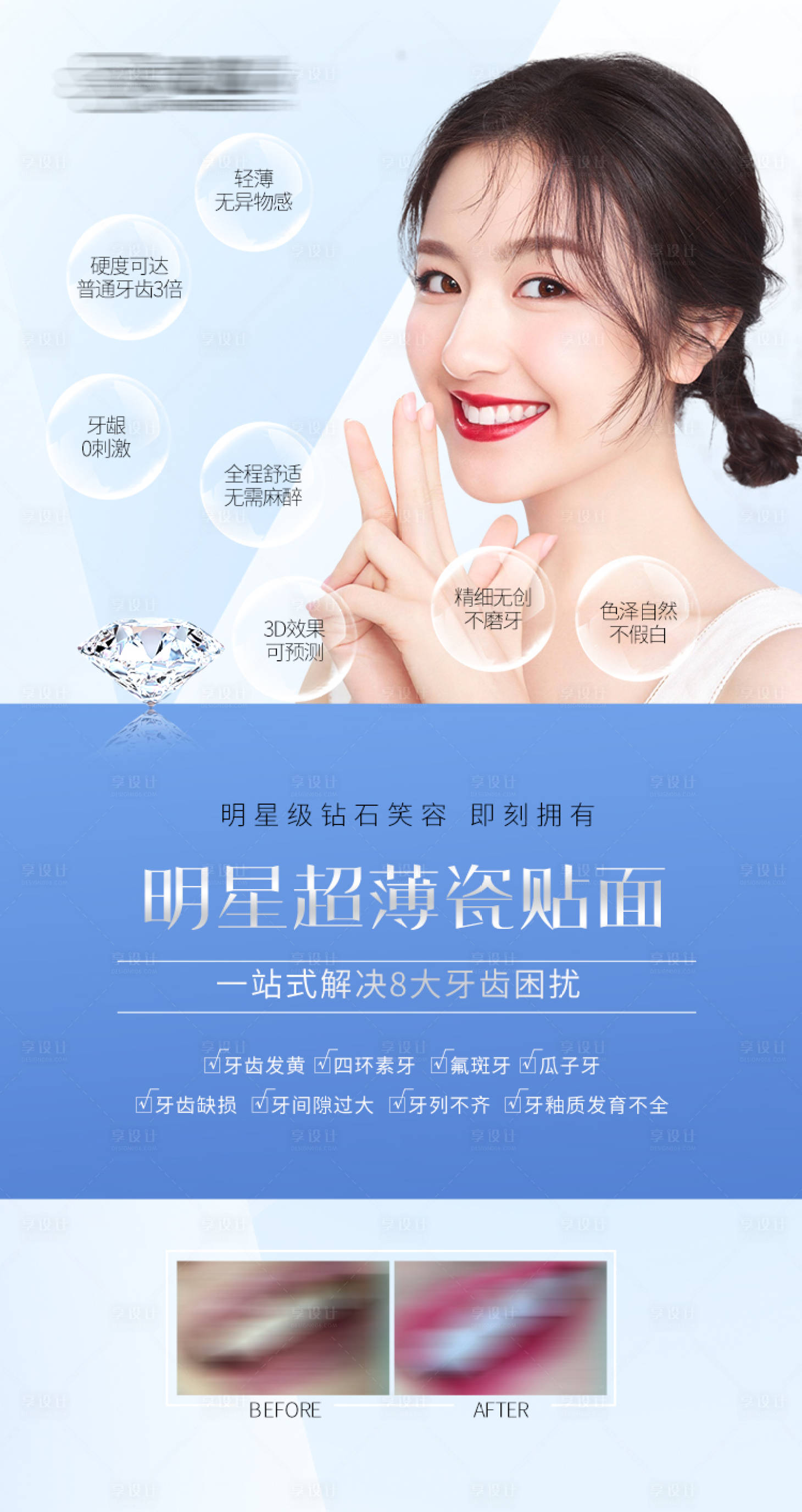 源文件下載【享設(shè)計】搜索編號：81140009573245089【牙齒美容海報】