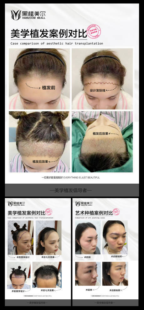 源文件下载【医美美容植发植眉高端大气宣传系列海报】编号：49990009392391662