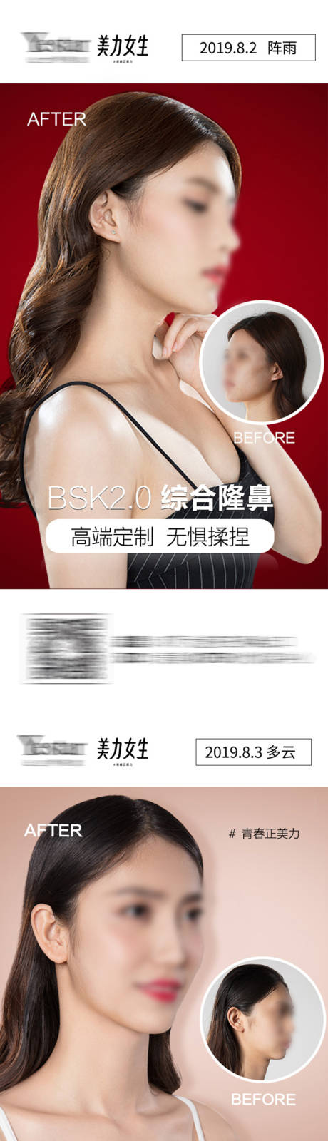 源文件下载【医美案例早安】编号：20220411113444551