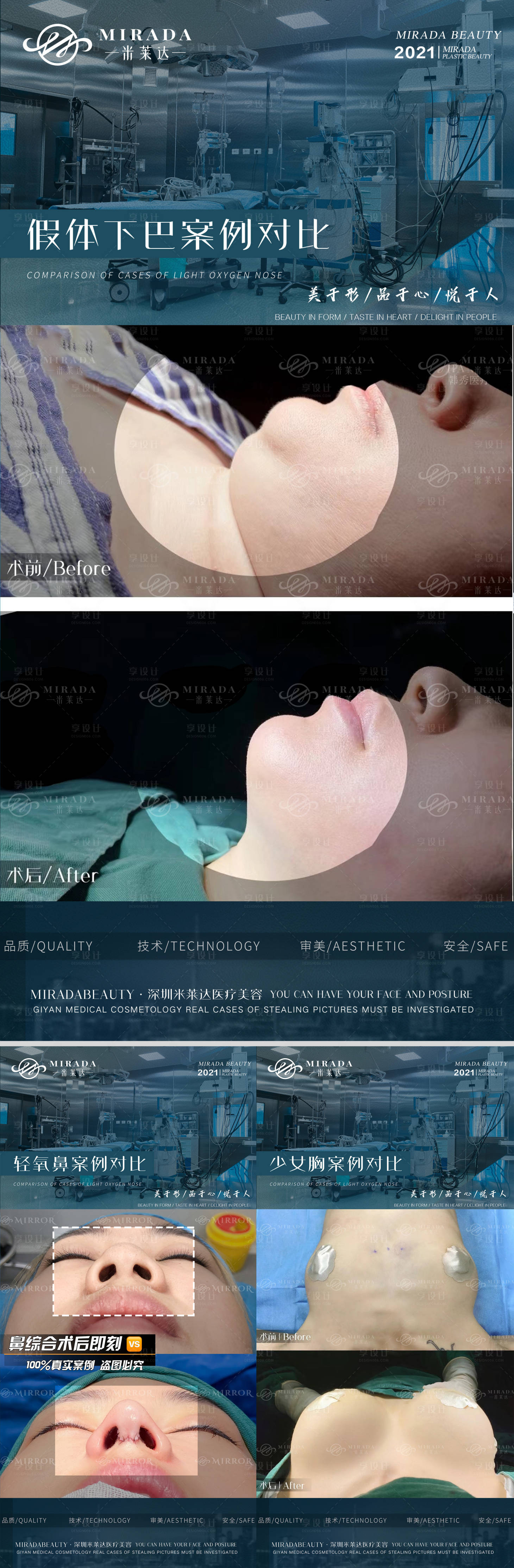 源文件下載【享設(shè)計(jì)】搜索編號(hào)：53580009567198205【醫(yī)美項(xiàng)目案例對(duì)比系列海報(bào)】