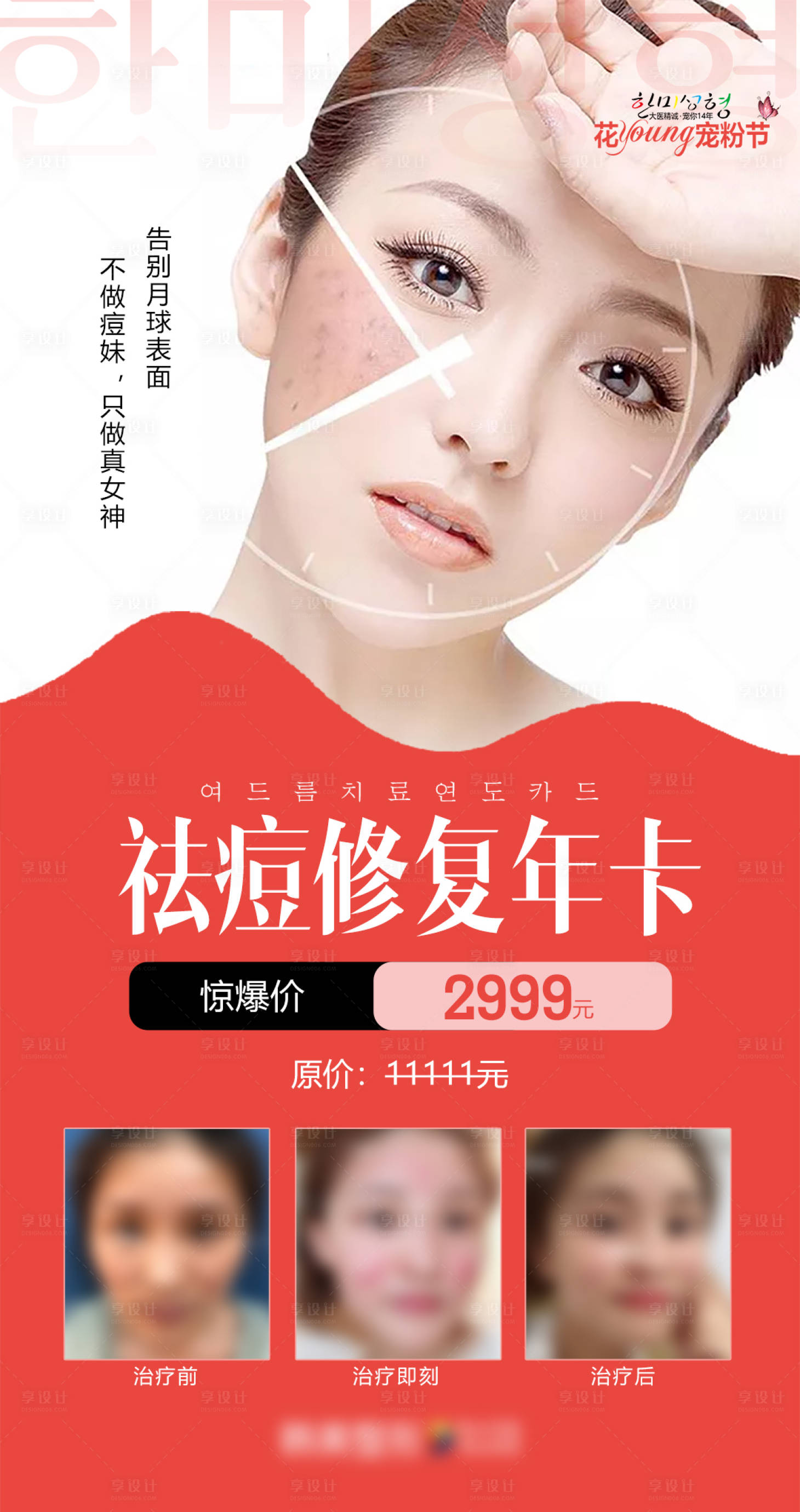 源文件下載【享設(shè)計】搜索編號：62490009504403999【醫(yī)學(xué)美容祛痘修復(fù)年卡促銷海報】